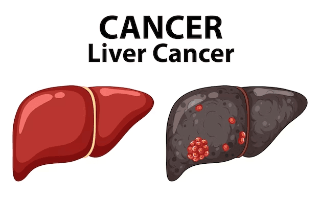 Liver Cancer ribbon